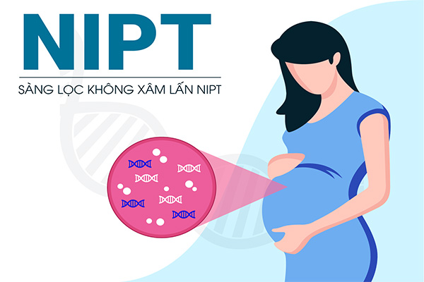 Những mẹ bầu nào cần thực hiện NIPT?