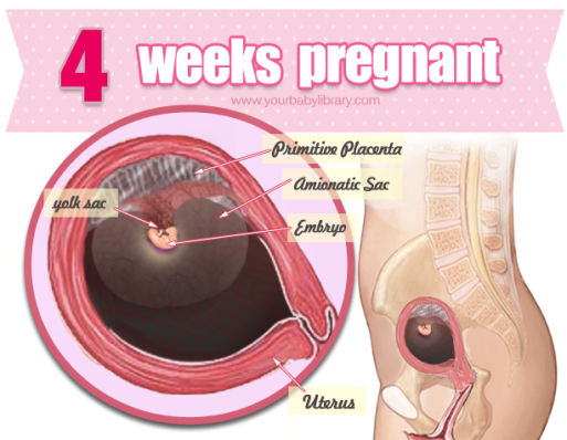 siêu âm thai 4 tuần tuổi