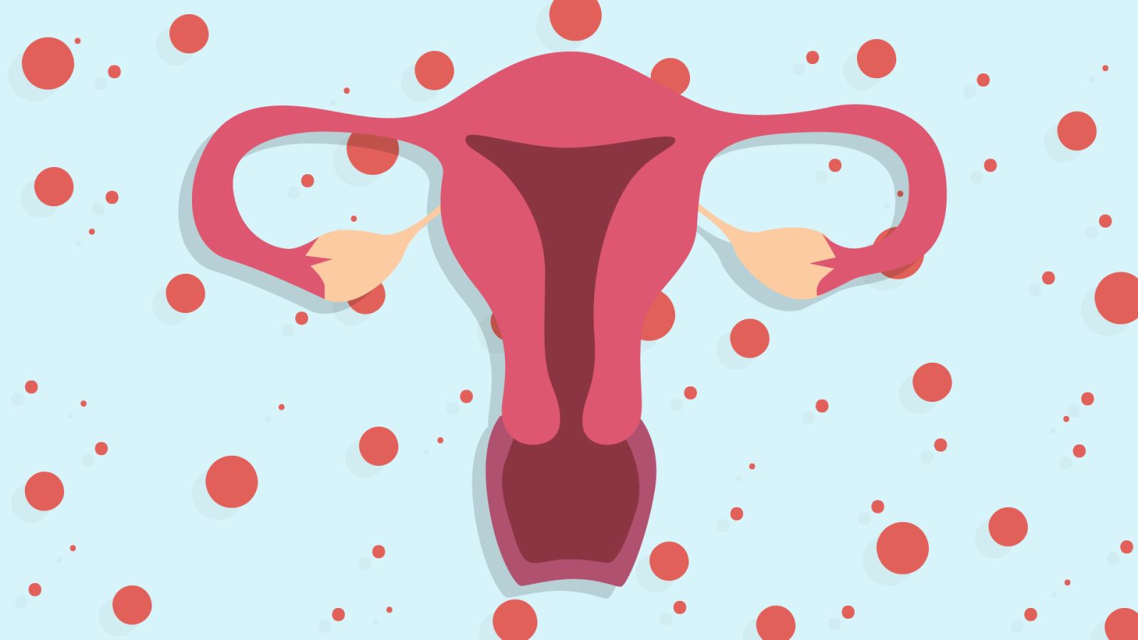 Chủ quan không điều trị, nữ bệnh nhân phải cắt tử cung toàn phần vì khối u xơ tử cung phát triển tương đương thai 8 tuần tuổi
